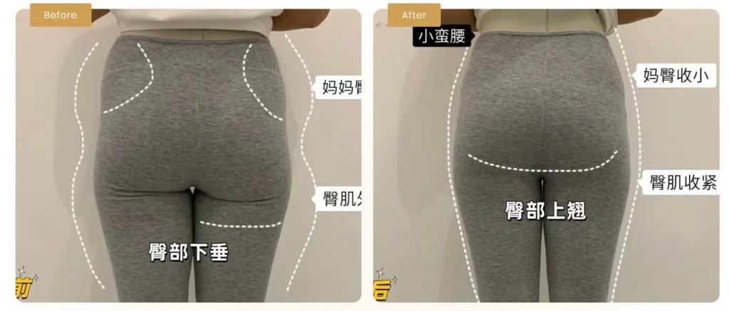 Free Skin & Body's Results for Myofascial Rebalancing Therapy as diastasis recti natural therapy